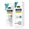Acne Face Wash, Gentle Clear Clarifying Acne Cream Cleanser with Niacinamide & Arbutin & Centella, Deep Cleans & Treats Acne Prone Skin, For Sensitive