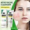 Acne Face Wash, Gentle Clear Clarifying Acne Cream Cleanser with Niacinamide & Arbutin & Centella, Deep Cleans & Treats Acne Prone Skin, For Sensitive